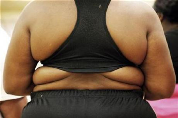 Female Fat Prejudice Exists Even After Weight Loss