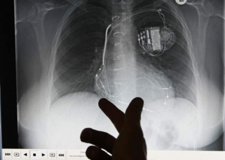 Implantable cardioverter defibrillators, or ICDs, deliver a jolt of electricity to correct life-threatening heart rhythms and cost upwards of $35,000 each
