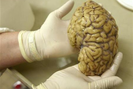 Lab assistant holds hemisphere of healthy brain at Belle Idee University Hospital in Chene-Bourg